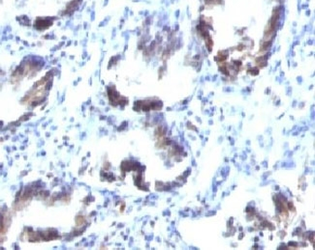 SM22 alpha Antibody / Transgelin