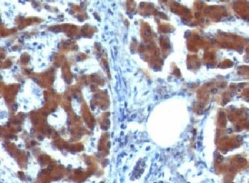 RBP Antibody / Retinol Binding Protein 1