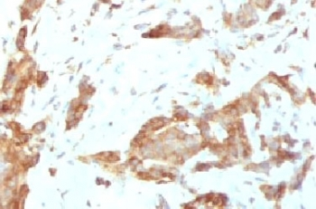 GRP94 Antibody / HSP90B1