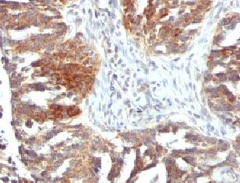 VEGFA Antibody / Vascular Endothelial Growth Factor A