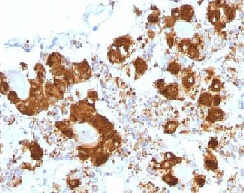 CLIP Antibody / ACTH