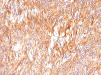 Calnexin Antibody