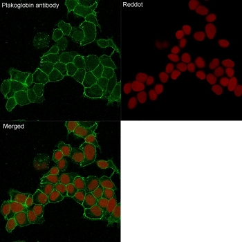 Gamma Catenin Antibody / Plakoglobin