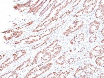 Retinoblastoma Antibody / Rb1