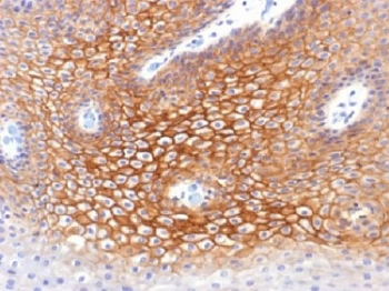 Gamma Catenin Antibody / Plakoglobin