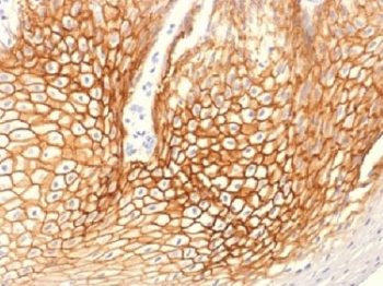 Gamma Catenin Antibody / Plakoglobin