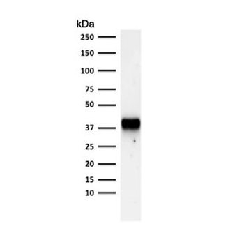 AMACR / p504S Antibody (Prostate Cancer Marker)