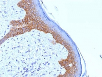 Desmoglein 3 Antibody / DSG3