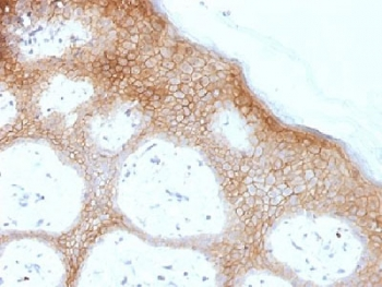 Desmoglein 1 Antibody / DSG1
