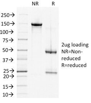 Desmoglein 2 Antibody / DSG2