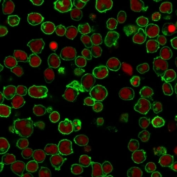 CD45 Antibody (Leukocyte marker)