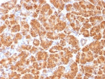 Clatherin Light Chain Antibody (LCA/LCB)