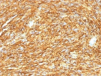 DOG1 Antibody / TMEM16A / ANO1