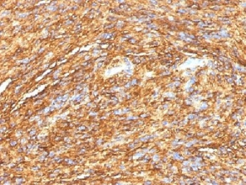 DOG1 Antibody / TMEM16A / ANO1