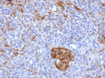 FTL Antibody / Ferritin light chain