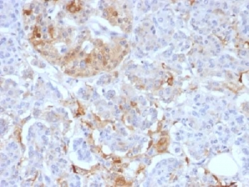 FTL Antibody / Ferritin light chain