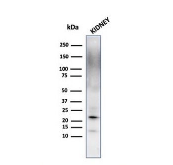 FTL Antibody / Ferritin light chain