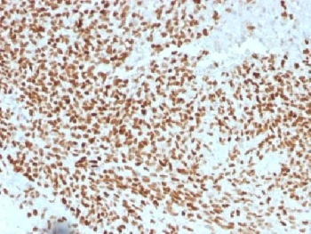 NKX2.2 Antibody