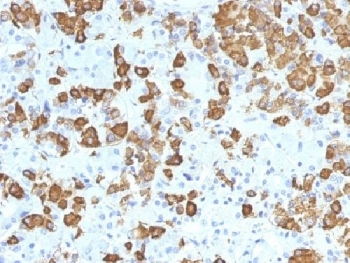 Growth Hormone Antibody / GH1