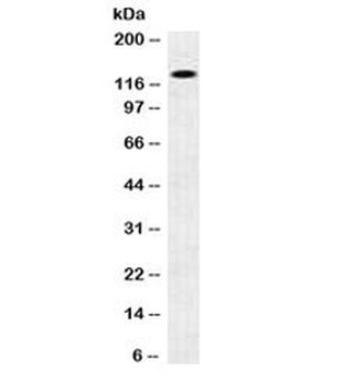 N-Cadherin Antibody / CDH2