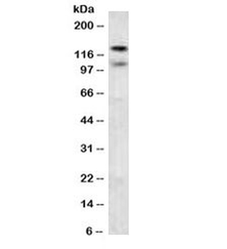 N-Cadherin Antibody / CDH2