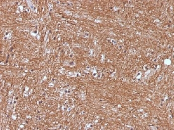 NSE Antibody / Neuron Specific Enolase
