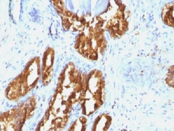 PSAP Antibody / Prostate Specific Acid Phosphatase