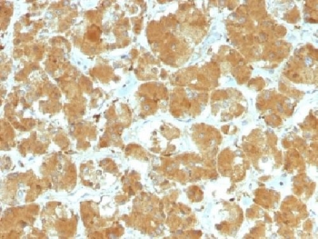 Thyroid Stimulating Hormone Receptor / TSHR Antibody (alpha chain)