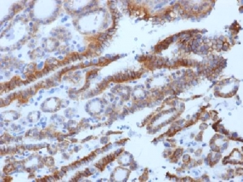 Thyroid Stimulating Hormone Receptor / TSHR Antibody (beta chain)