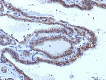 Thyroid Stimulating Hormone Receptor / TSHR Antibody (alpha chain)