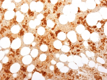 Transferrin Receptor Antibody / TFRC / CD71