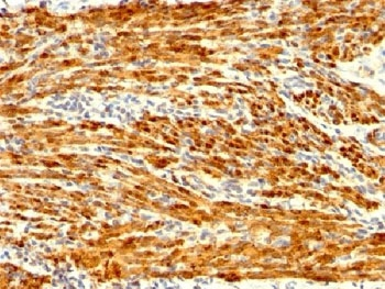 Calponin 1 Antibody