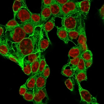 Glypican 3 Antibody / GPC3