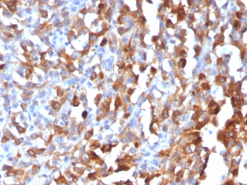 MART-1 / Melan-A Antibody