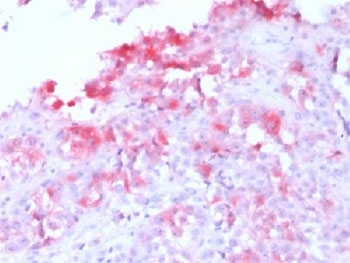 MART-1 / Melan-A Antibody