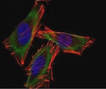S100B Antibody