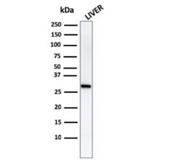 Prohibitin Antibody / PHB