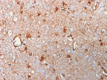 S100B Antibody