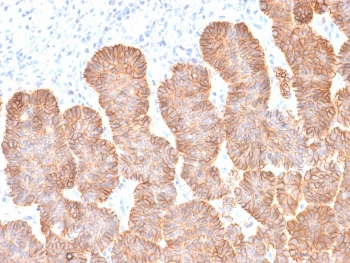 EpCAM Antibody / Extracellular domain