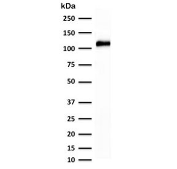 Cadherin 16 Antibody