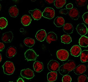 CD45RB Antibody (B-cell marker)