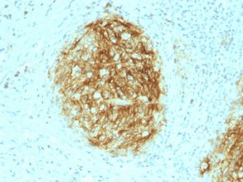 CD21 Antibody