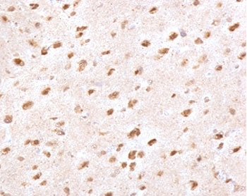 Ubiquitin Antibody