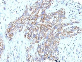 NCAM / CD56 Antibody Cocktail