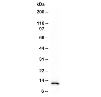 S100A4 Antibody / FSP1