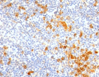 IL3RA Antibody / CD123