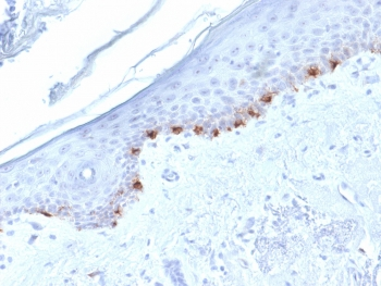 TRP1 / Tyrosinase-Related Protein-1 Antibody