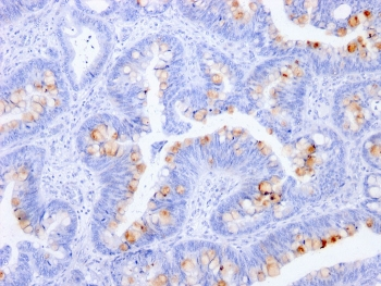 CEA Antibody / Carcinoembryonic Antigen