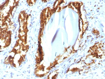 PSAP Antibody / Prostate Specific Acid Phosphatase