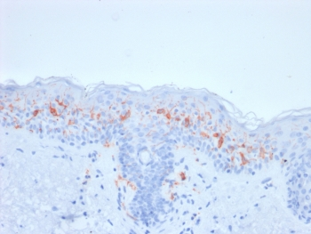 CD1a Antibody